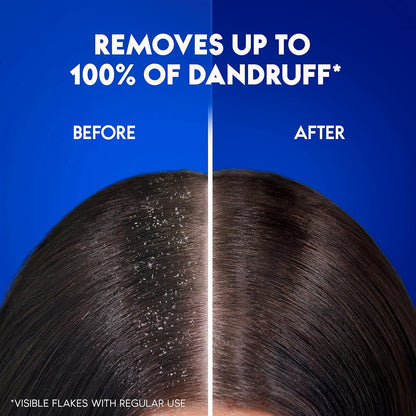 Head & Shoulders Daily Clean Anti-Dandruff Shampoo for Normal Hair, 400ml