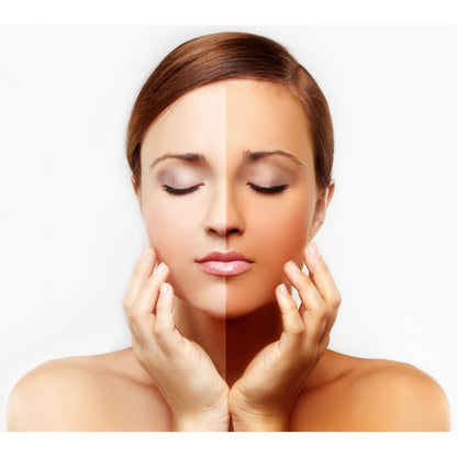 FAIR & LOVELY ANTI MARKS 100g
